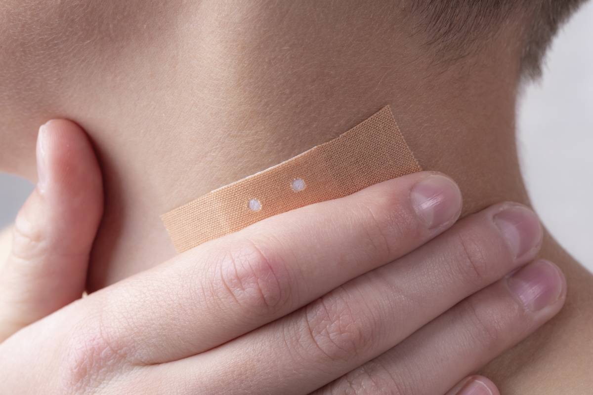 Analgesic Patches and Films for Postoperative Pain