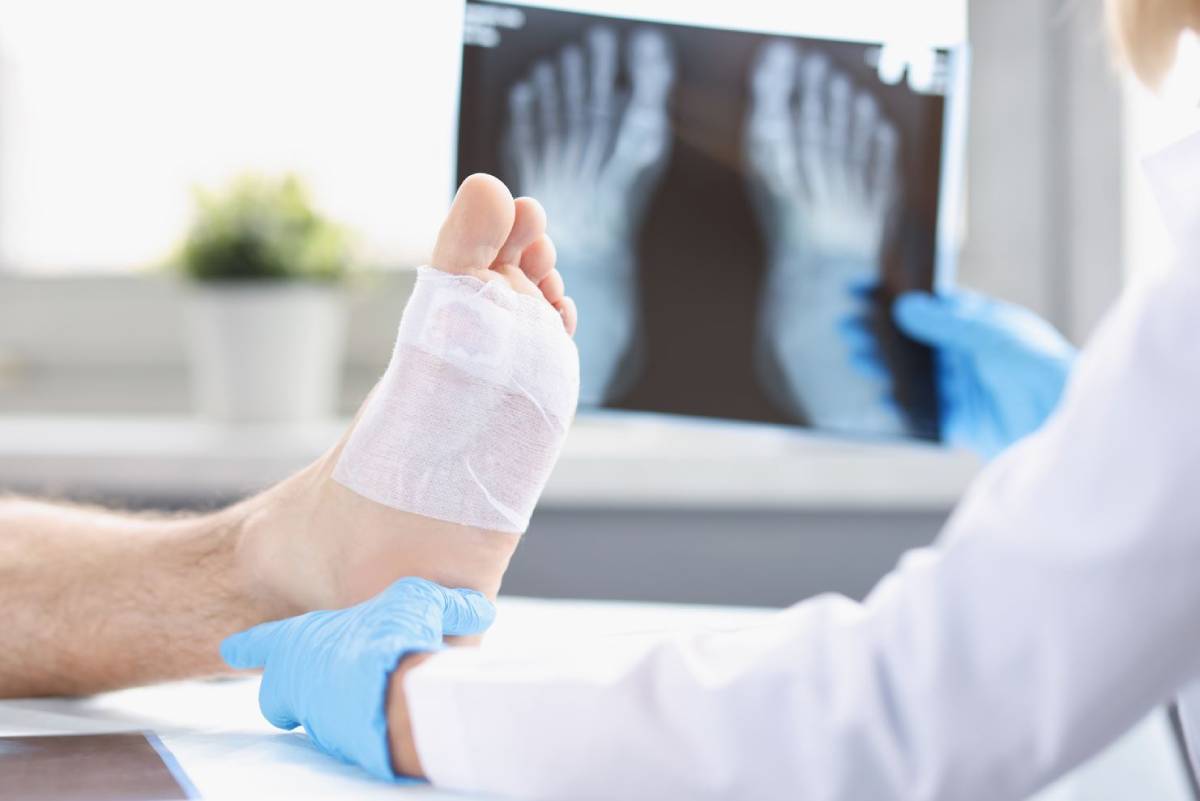 General Anesthesia vs. Conscious Sedation for Podiatric Surgery 