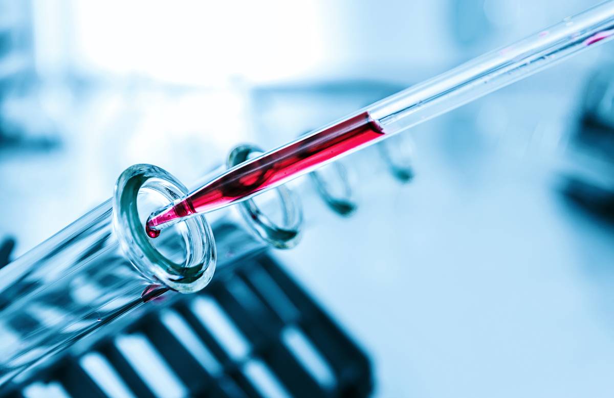 Blood Test Before Anesthesia
