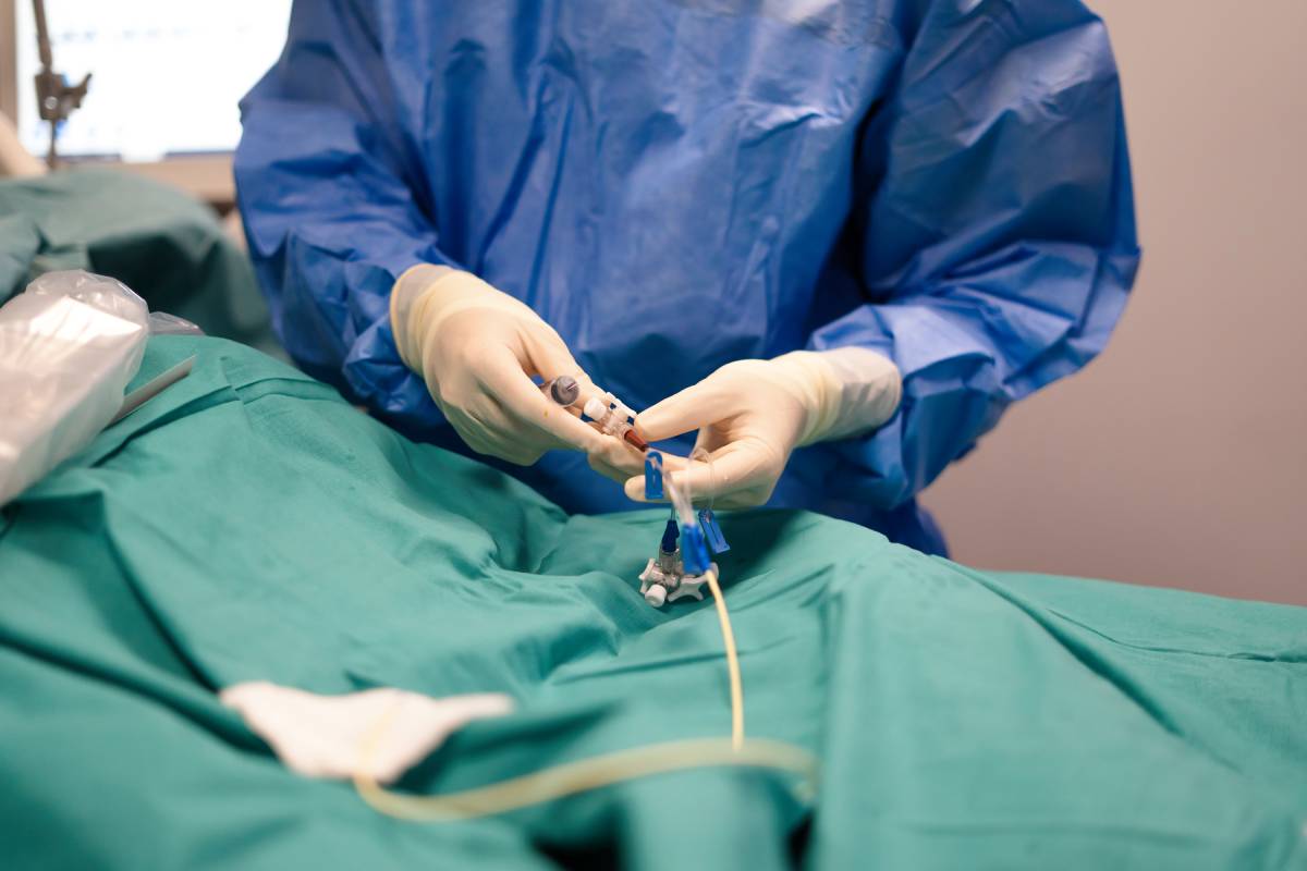 Nerve Block Catheter