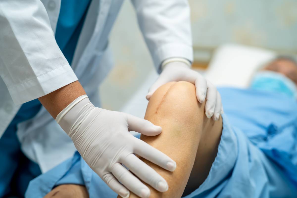 Scarring After Orthopedic Surgery