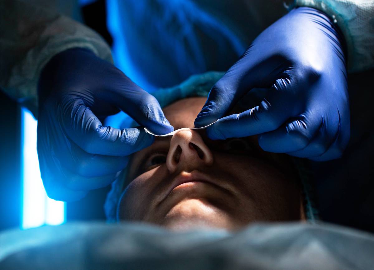 Septoplasty: Overview and Anesthesia 