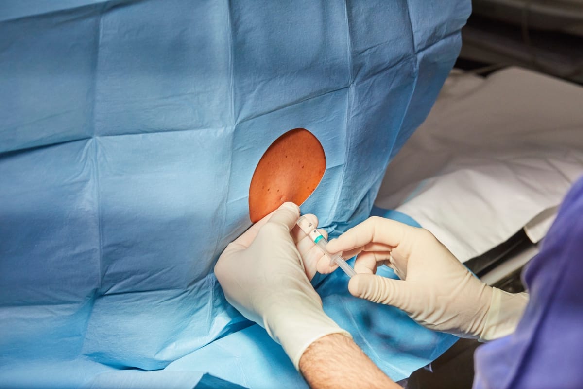 total knee arthroplasty