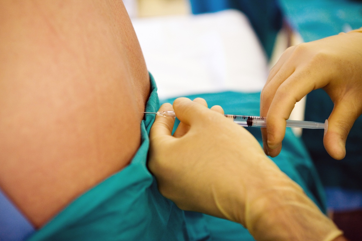 Lateral vs. Sitting Position for Neuraxial Anesthesia